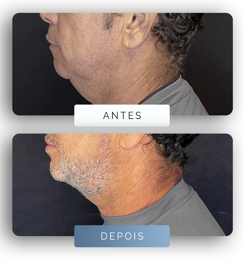Página - Antes e depois 3